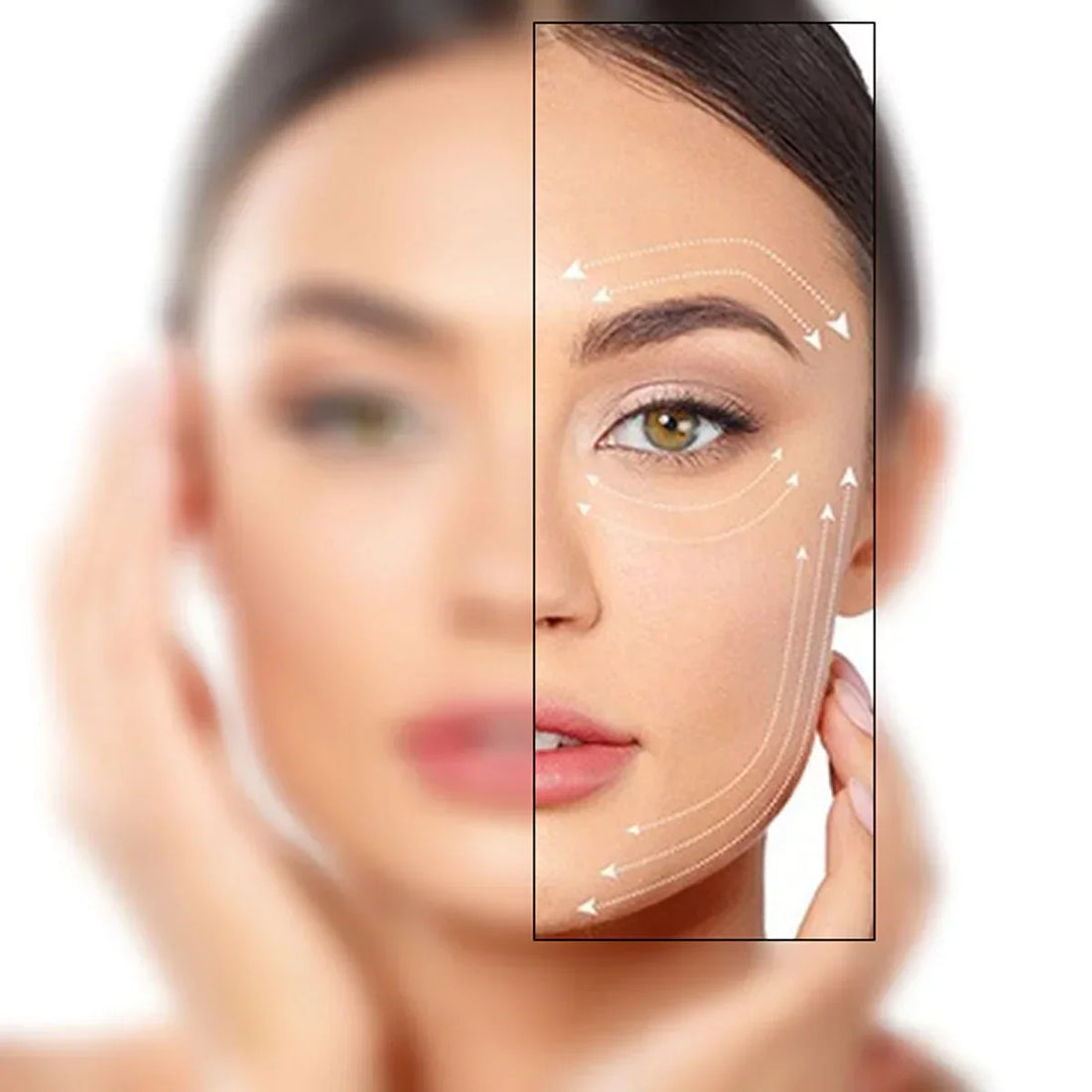 Top 20 Benefits of Plasma Fibroblast Treatment: What to Expect